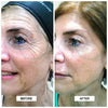 BeautyFace™ Microcurrent Facelift Massager | Voor een jongere en stralende huid in enkele minuten