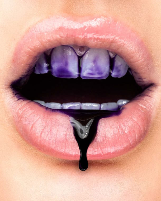 MYsmile™ | Geniet zonder risico van een stralend witte glimlach! | 1+1 GRATIS